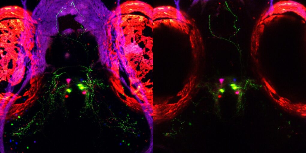 El cerebro tiene un botón oculto para dormir: lo descubren en peces cebra y abre la puerta a nuevos tratamientos
